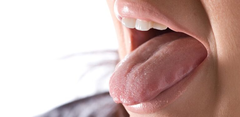 What Is a Scalloped Tongue?