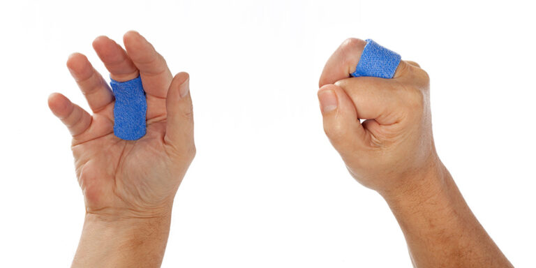 Trigger Finger Splint