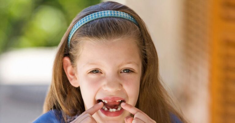 Causes Bone Loss in Teeth