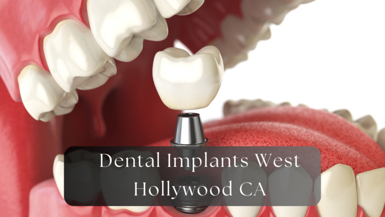 Dental Implants