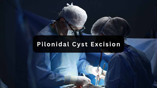 Pilonidal Surgery Recovery